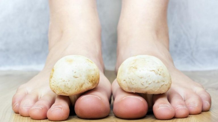 CUM SĂ SCAPI DE CIUPERCA O DATĂ PENTRU TOTDEAUNA