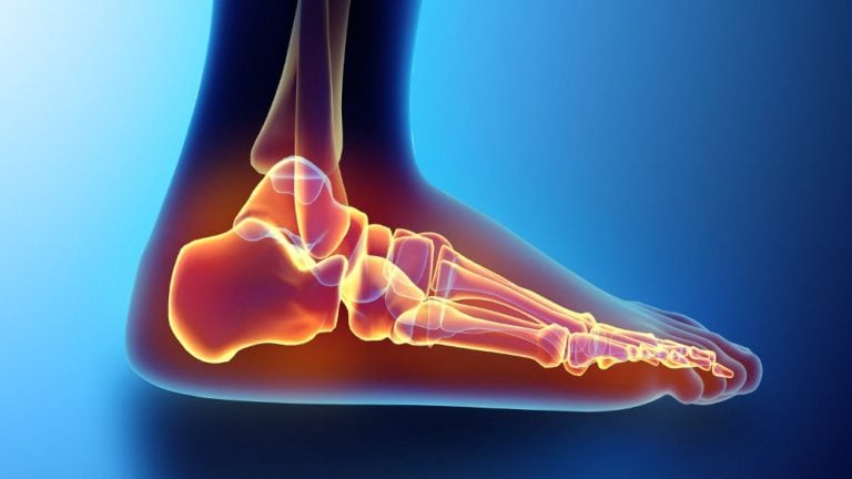 5 Modalități de a ușura durerea de călcâie