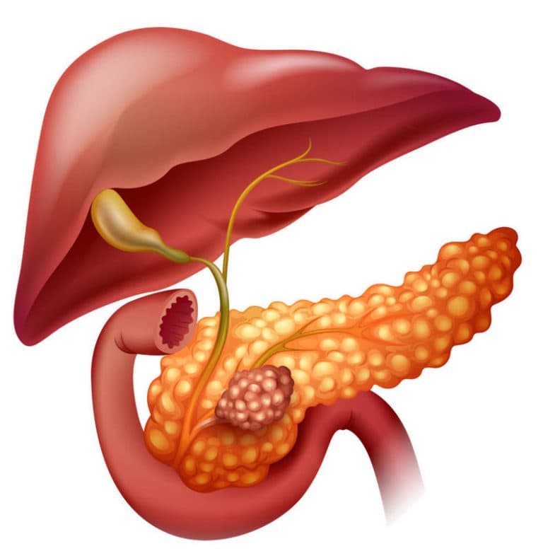 Top 9 Alimente Preferate ale Pancreasului