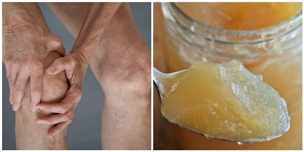 CU ACEASTĂ REȚETĂ VEȚI SCĂPA DE DURERILE DE ARTICULAȚII ÎN DOAR 7 ZILE