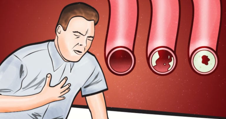 8 Alimente care vă vor curăța arterele – și vor adăuga 10 ani de viață