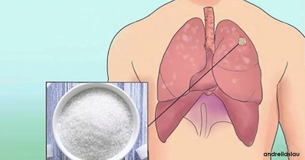 Cu Toții Avem Celule Canceroase În Organism. Iată Cum Să Le Împiedicăm Să Devină Tumori