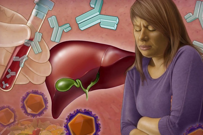 9 Semne care arată că toxinele otrăvesc ficatul