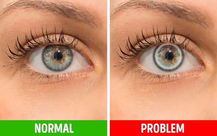 MODUL ÎN CARE CORPUL SEMNALEAZĂ PROBLEMELE DE SANATATE