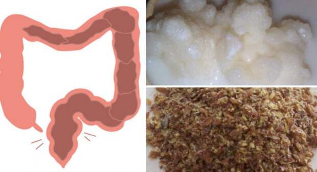 IATĂ 2 INGREDIENTE CARE ELIMINĂ KILOGRAME DE TOXINE DIN INTESTINE!