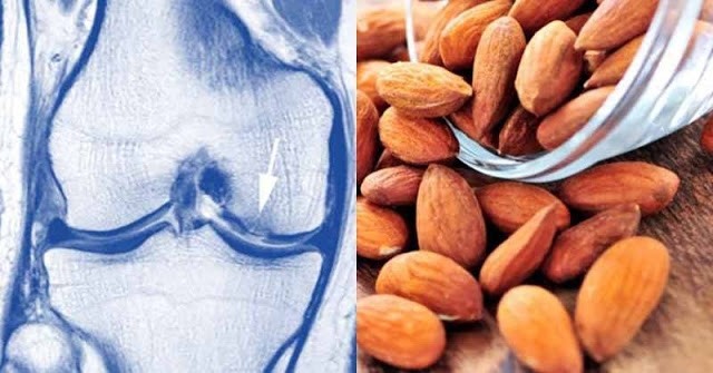 7 alimente care întăresc cartilajul oaselor și le restaurează rapid!