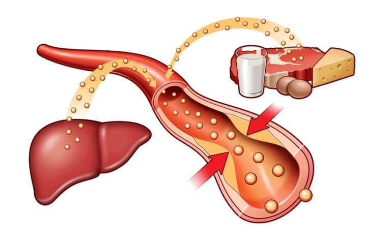 5 alimente pentru scăderea colesterolului