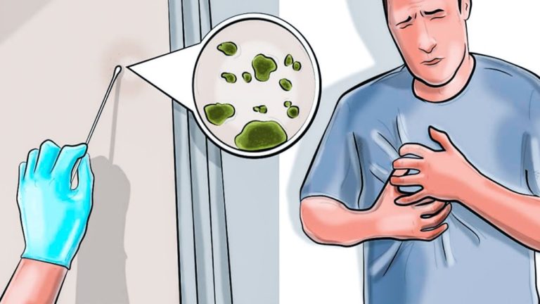 MUCEGAI – 7 SEMNE DE BOALĂ DIN CAUZA MUCEGAIULUI