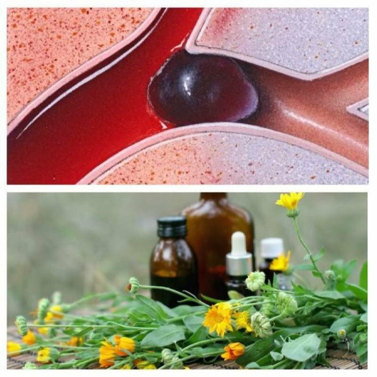 Remedii naturiste eficiente pentru tratamentul trombozei și subțierea sângelui