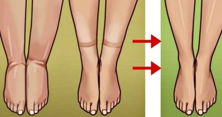 5 MOTIVE PENTRU CARE CORPUL TĂU REȚINE APA (ȘI CUM SĂ EVITĂM ASTA)