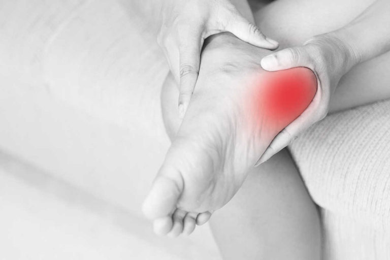 4 Remedii naturale eficiente pentru durerea călcâiului