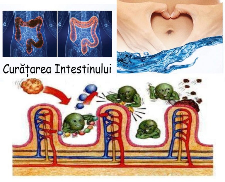 Curățarea intestinului cu remedii naturiste la domiciliu