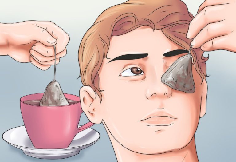 Cum să utilizați corect pungile de ceai pentru ochi?