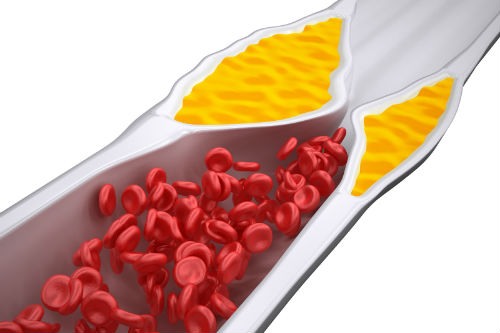 TOP – 8 Produse care curăță vasele